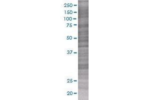 Western Blotting (WB) image for RGS3 293T Cell Transient Overexpression Lysate(Denatured) (ABIN1333312)