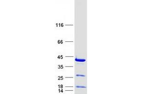 RPRD1B Protein (Myc-DYKDDDDK Tag)