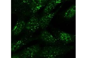 SNX1 antibody (5ug/ml) staining of formaldehyde-fixed SH5Y5Y cells detected with Alexa Fluor 488 in confocal microscopy. (Sorting Nexin 1 抗体)