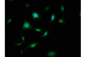 Immunofluorescence staining of U251 cells with ABIN7174025 at 1:200, counter-stained with DAPI. (FYN 抗体  (AA 154-270))