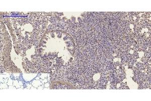 Immunohistochemistry of paraffin-embedded Rat lung tissue using α-SMA Polyclonal Antibody at dilution of 1:200. (alpha-SMA 抗体)