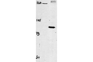 Western blot of chicken brain tissue incubated with CLC4 Antibody (C-term). (CLCN4 抗体  (C-Term))