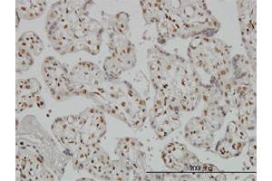 Immunohistochemistry (Formalin-fixed Paraffin-embedded Sections) (IHC (fp)) image for anti-Runt-Related Transcription Factor 2 (RUNX2) (AA 251-350) antibody (ABIN560185)