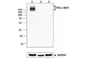 Western Blotting (WB) image for anti-TRA-1-60(R) antibody (ABIN2660534) (TRA-1-60(R) 抗体)