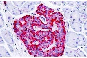 Human, Pancreas, Islet: Formalin-Fixed Paraffin-Embedded (FFPE) (GPER 抗体  (Cytoplasmic Domain))