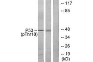 Western blot analysis of extracts from Ovary cancer and K562 cells, using p53 (Phospho-Thr18) Antibody. (p53 抗体  (pThr18))