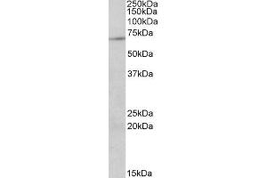 ABIN571028 staining (2µg/ml) of Jurkat lysate (RIPA buffer, 35µg total protein per lane). (PRMT5 抗体  (Internal Region))