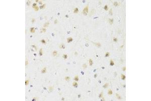 Immunohistochemistry of paraffin-embedded rat brain using PAWR Antibody. (PAWR 抗体)