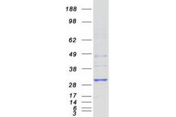 HLA-DRB4 Protein (Myc-DYKDDDDK Tag)