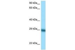 Image no. 1 for anti-Tissue Factor Pathway Inhibitor (Lipoprotein-Associated Coagulation Inhibitor) (TFPI) (C-Term) antibody (ABIN6748178) (TFPI 抗体  (C-Term))
