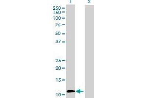 Lane 1: BRWD1 transfected lysate ( 13. (BRWD1 293T Cell Transient Overexpression Lysate(Denatured))