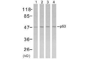 Image no. 1 for anti-Tumor Protein P53 (TP53) (Ser315) antibody (ABIN197254) (p53 抗体  (Ser315))