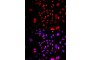 Immunofluorescence (IF) image for anti-Replication Factor C (Activator 1) 4, 37kDa (RFC4) antibody (ABIN1876673) (RFC4 抗体)