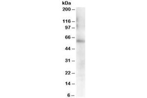 Western blot testing of mouse spleen lysate with FGR antibody at 0. (Fgr 抗体)
