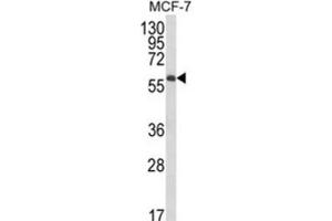 Western Blotting (WB) image for anti-Interleukin 10 Receptor, alpha (IL10RA) antibody (ABIN3003900) (IL-10RA 抗体)