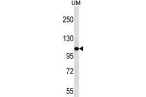 Western blot analysis in UM cell line lysates (35ug/lane) using Myosin-IIIb Antibody (C-term). (MYO3B 抗体  (C-Term))