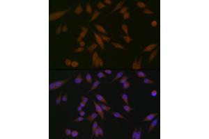 Immunofluorescence analysis of HeLa cells using P Rabbit mAb (ABIN1682842, ABIN3019312, ABIN3019313 and ABIN7101749) at dilution of 1:100 (40x lens). (PAWR 抗体)