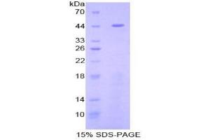 SDS-PAGE analysis of Rat Fibulin 1 Protein. (Fibulin 1 Protein (FBLN1))