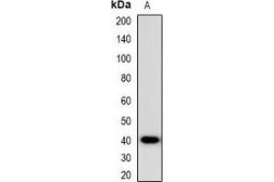 Western blot analysis of CCR5 expression in HEK293T (A) whole cell lysates. (CCR5 抗体)