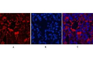 Immunofluorescence analysis of mouse lung tissue. (LC3B 抗体)