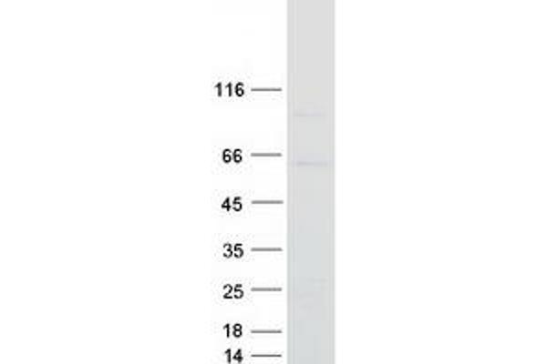 SEMA3D Protein (Myc-DYKDDDDK Tag)