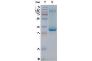 Human AD-Nanodisc, Flag Tag on SDS-PAGE (ADGRE2 蛋白)