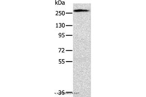 Western blot analysis of Huvec cell, using TLN1 Polyclonal Antibody at dilution of 1:200 (TLN1 抗体)