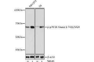 Western blot analysis of extracts of various cell lines, using Phospho-p70 S6 Kinase 1-T421/S424 Rabbit mAb (ABIN6135340, ABIN6136296, ABIN6136297 and ABIN7101878) at 1:1000 dilution. (RPS6KB1 抗体  (pSer424, pThr421))