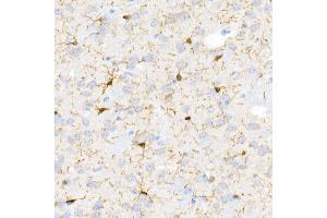 Immunohistochemistry of paraffin-embedded Mouse brain using /IB antibody (ABIN7265554) at dilution of 1:100 (40x lens). (Iba1 抗体)