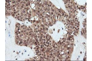 Image no. 6 for anti-Parvin, alpha (PARVA) antibody (ABIN1496441) (Parvin alpha 抗体)