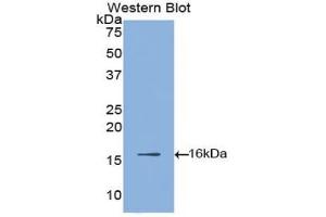 Detection of Recombinant HIF1a, Gallus using Polyclonal Antibody to Hypoxia Inducible Factor 1 Alpha (HIF1a) (HIF1A 抗体  (AA 35-155))