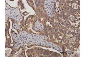 Immunohistochemistry (Formalin-fixed Paraffin-embedded Sections) (IHC (fp)) image for anti-Stress-Induced-phosphoprotein 1 (STIP1) (AA 1-543) antibody (ABIN524365)