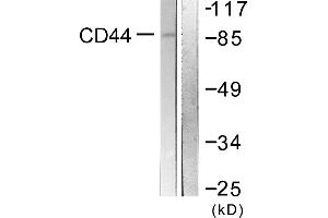 Western blot analysis of extracts from NIH/3T3 cells, treated with PMA (250ng/ml, 5mins), using CD44 (Ab-706) antibody. (CD44 抗体)