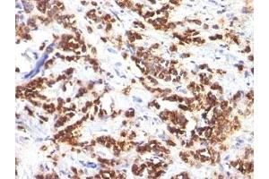 Immunohistochemistry (Formalin-fixed Paraffin-embedded Sections) (IHC (fp)) image for anti-Milk Fat Globule-EGF Factor 8 Protein (MFGE8) antibody (ABIN3025866)