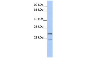 BTF3L3 antibody used at 1 ug/ml to detect target protein. (BTF3P13 抗体  (Middle Region))