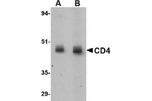 Western Blotting (WB) image for anti-CD4 (CD4) antibody (ABIN1031728) (CD4 抗体)