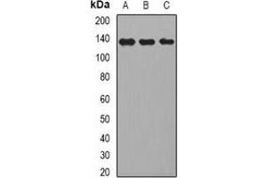 Western blot analysis of CD22 expression in HepG2 (A), Raji (B), mouse liver (C) whole cell lysates. (CD22 抗体)
