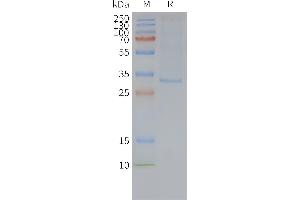 Human MRG-Nanodisc, Flag Tag on SDS-PAGE (MRGPRX2 蛋白)