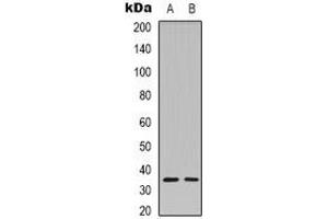 Western blot analysis of Caspase 3 p12 expression in Hela (A), MCF7 (B) whole cell lysates. (Caspase 3 p12 抗体)
