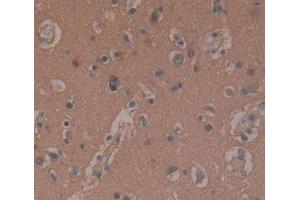 DAB staining on fromalin fixed paraffin- embedded brain tissue) (SNAP25 抗体  (AA 1-206))