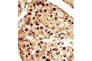 Image no. 2 for anti-Transient Receptor Potential Cation Channel, Subfamily M, Member 7 (TRPM7) (C-Term) antibody (ABIN360499) (TRPM7 抗体  (C-Term))