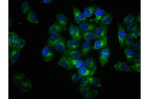 Immunofluorescence (IF) image for anti-Linker For Activation of T Cells (LAT) (pTyr191) antibody (ABIN7127705)