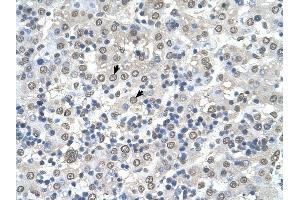 CDR2 antibody was used for immunohistochemistry at a concentration of 4-8 ug/ml to stain Hepatocytes (arrows) in Human Liver. (CDR2 抗体  (N-Term))