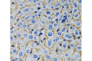 Immunohistochemistry of paraffin-embedded Rat liver using RAF1 Polyclonal Antibody at dilution of 1:100 (40x lens). (RAF1 抗体)