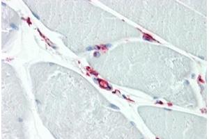 Human Skeletal Muscle: Formalin-Fixed, Paraffin-Embedded (FFPE) (CD34 抗体  (AA 366-382))
