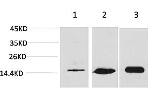 Western blot analysis of 1) Hela, 2) 3T3, 3) rat brain tissue using MAP LC3β Polyclonal Antibody. (LC3B 抗体)