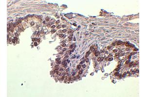 Immunohistochemistry (IHC) image for anti-Forkhead Box A1 (FOXA1) (C-Term) antibody (ABIN185021)