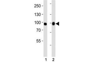 Western blot analysis of lysate from (1) A549 and (2) HeLa cell line using FGFR3 antibody at 1:1000. (FGFR3 抗体  (AA 449-482))