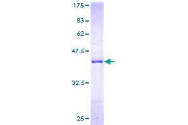 TXNL4A Protein (AA 1-142) (GST tag)