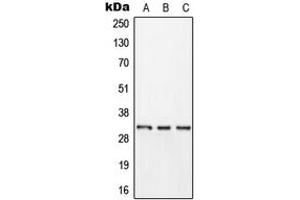 Western blot analysis of Kallikrein 11 expression in HEK293T (A), HepG2 (B), rat brain (C) whole cell lysates. (Kallikrein 11 抗体  (Center))